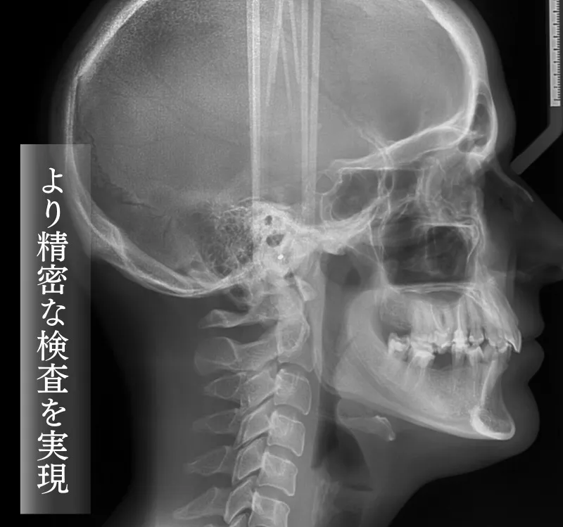 セファロ
