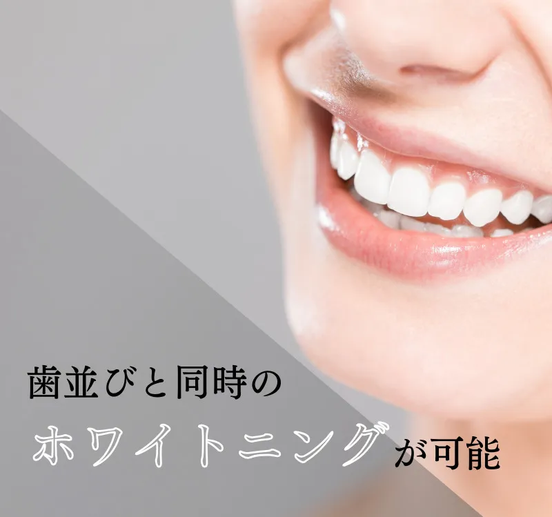 ホワイトニングが可能