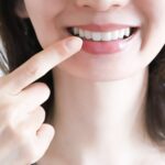 インプラントとは？仕組みから費用・寿命までわかりやすく解説