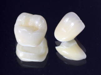 ジルコニアクラウン ジルコニアクラウン